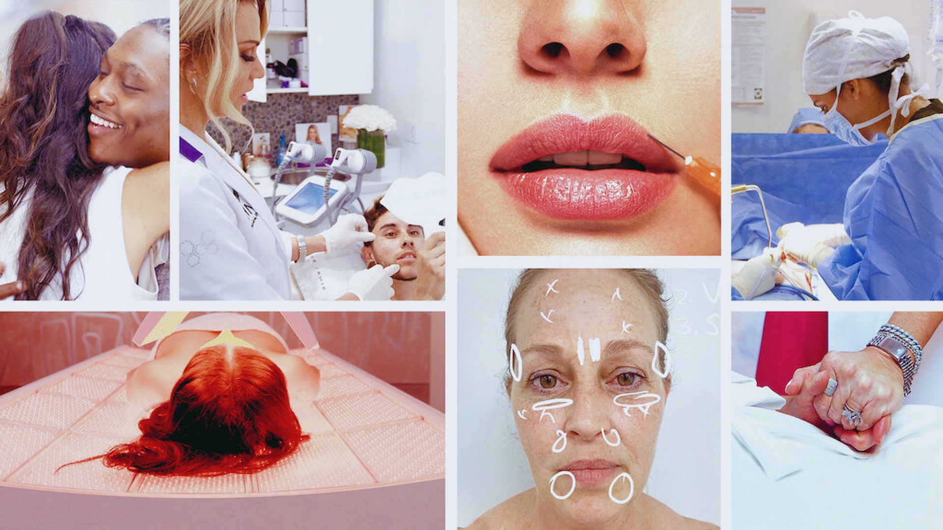 Skin Decision: Before and After 1. Sezon 1. Bölüm